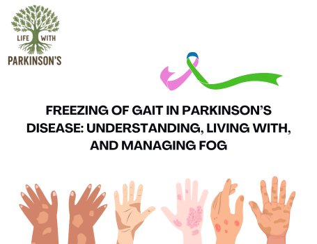 Freezing of Gait in Parkinson’s Disease: Understanding, Living With, and Managing FOG